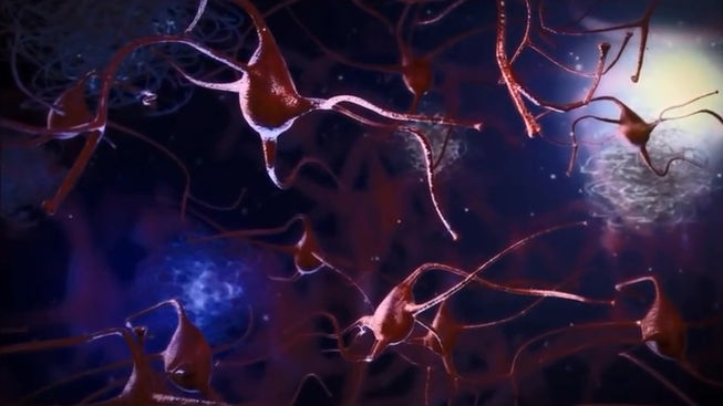 Cannabis and Alzheimer's Disease - Short Documentary